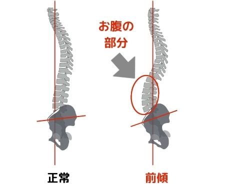 骨盤は背骨と直接接している骨であるため、骨盤が傾くと背骨のラインに大きな影響を及ぼす場合があります
